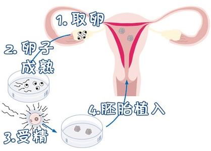 靠谱借卵代怀多少费用